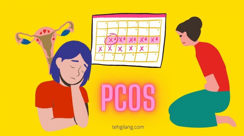 pcos adalah gangguan menstruasi yang harus diwaspadai