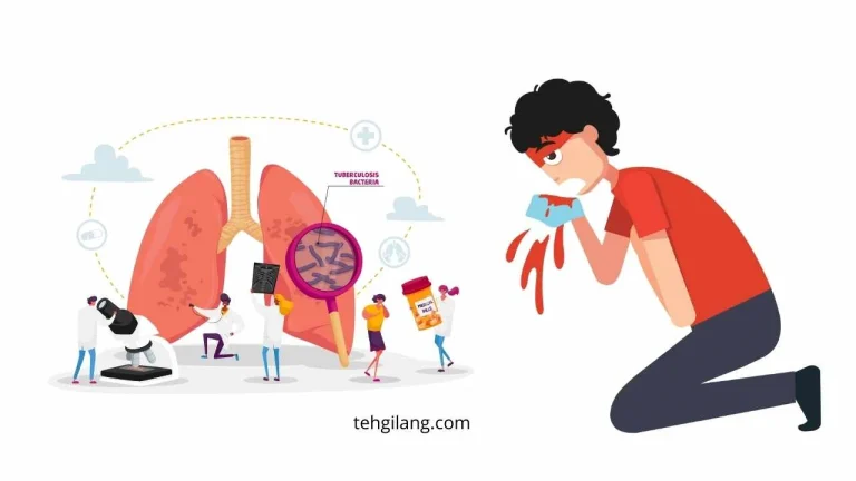 ciri ciri batuk tbc termasuk pada anak dan orang dewasa